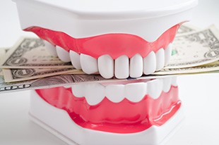 Bright white artificial teeth biting several dollar bills